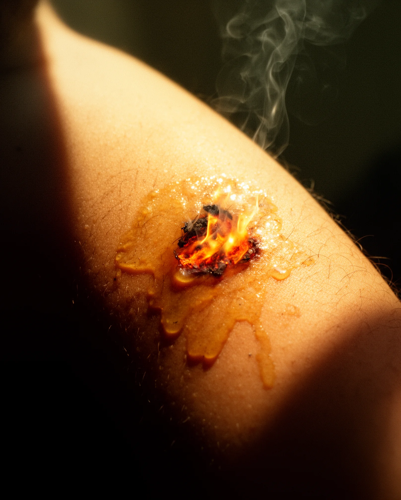 Arsuri de piele, cancer și ulei încins în soare